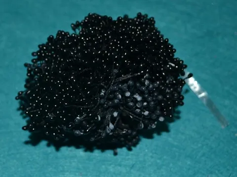 Тычинки на нитке